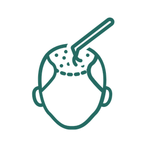 Hairline Planning & Design