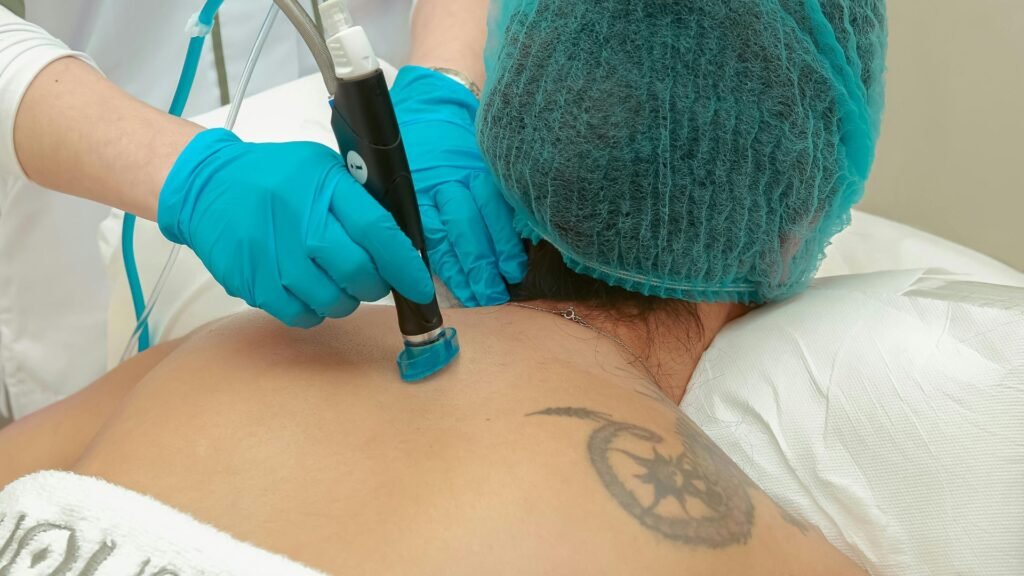 Advanced Laser Tattoo Removal Treatment in Ambattur, Chennai