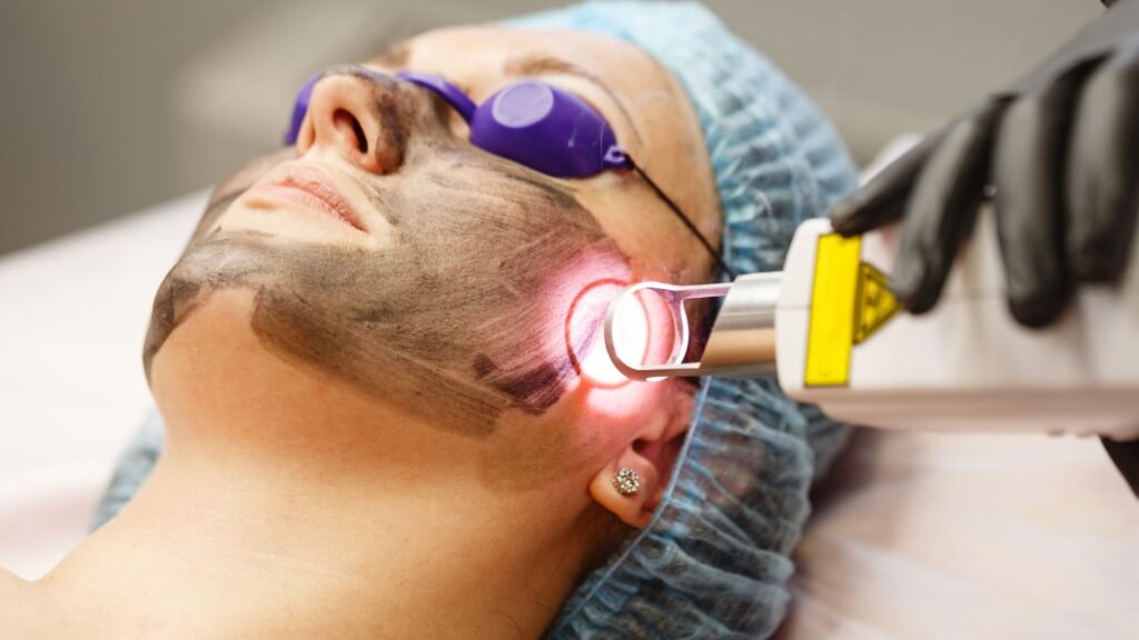 PICO & Carbon Laser Treatment