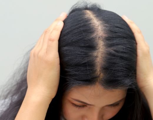Hair Loss Treatment for Women in Chennai – Causes & Effective Solutions