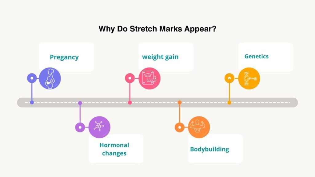 Why Do Stretch Marks Appear - Stretch Mark Removal Treatment