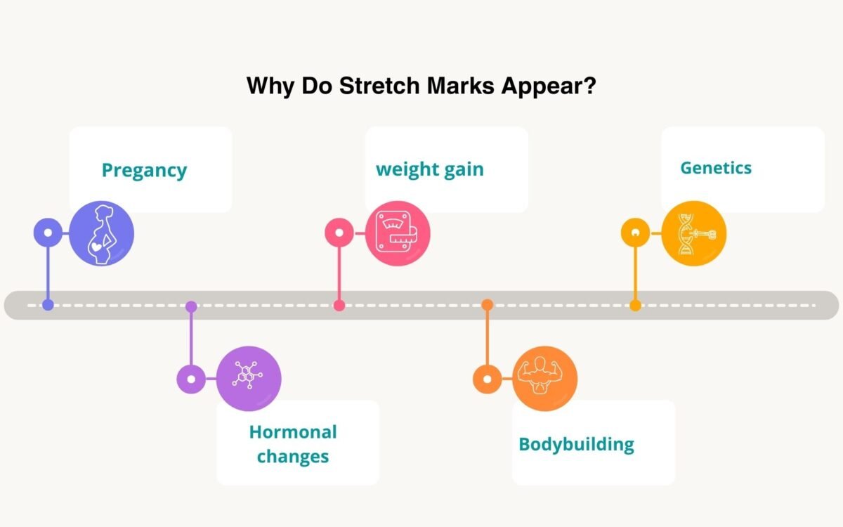 Why Do Stretch Marks Appear - Stretch Mark Removal Treatment