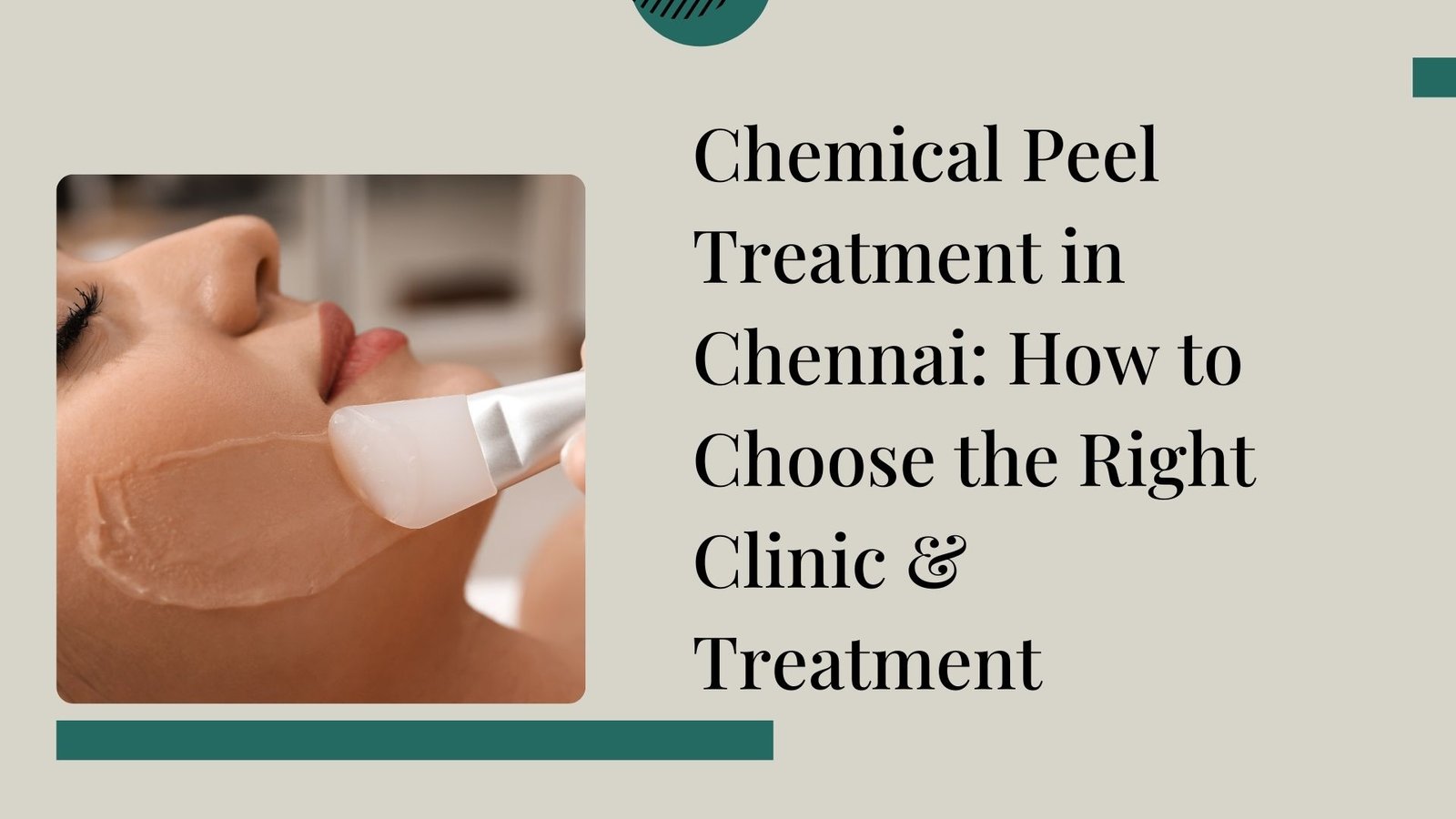 Chemical Peel Treatment in Chennai: How to Choose the Right Clinic & Treatment