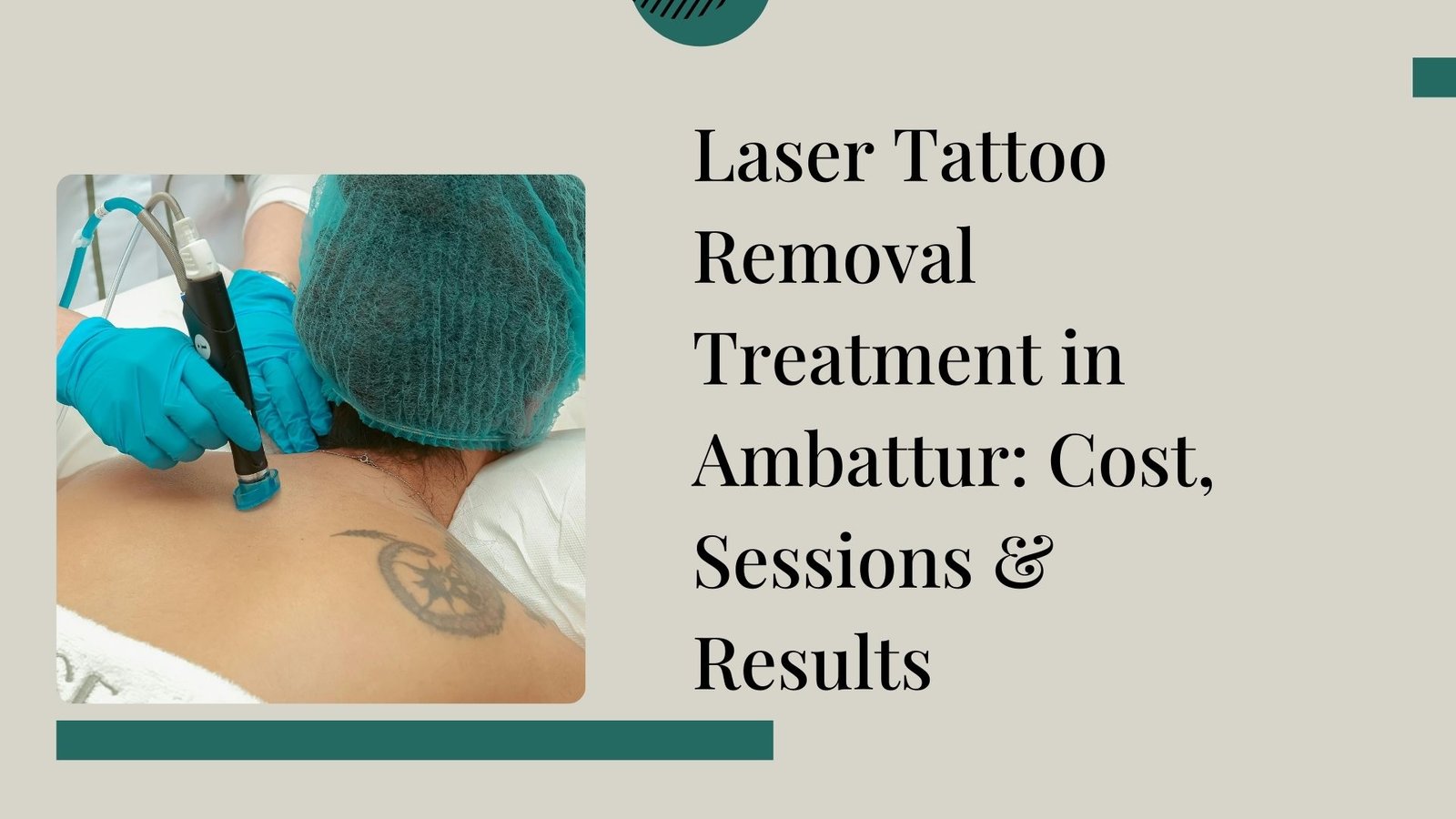 Laser Tattoo Removal in Ambattur – Safe & Effective