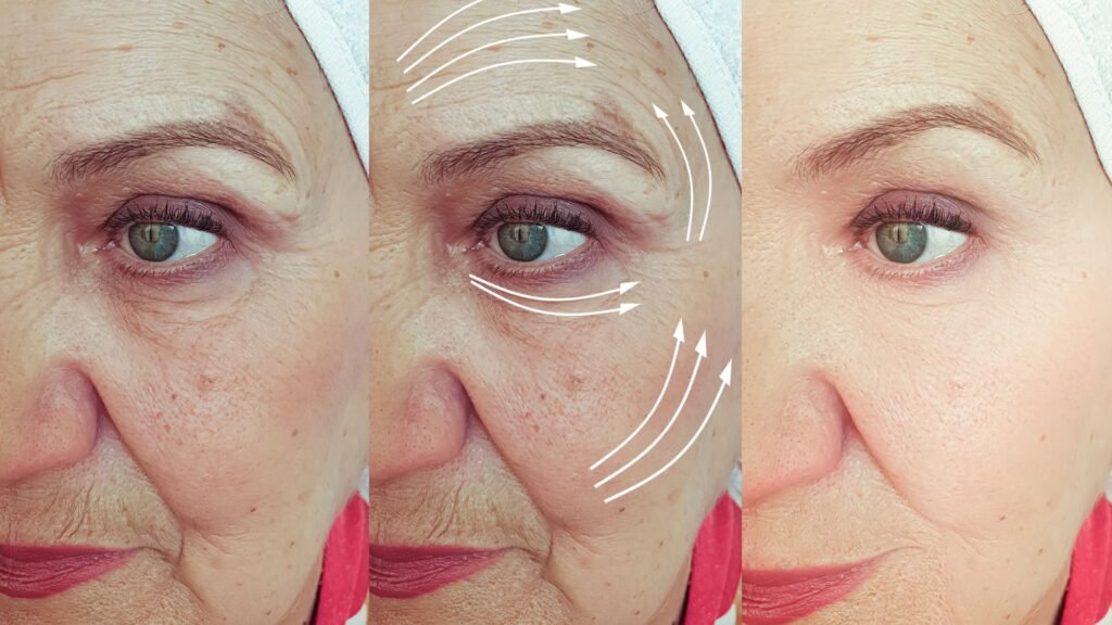 Pigmentation & Melasma Treatment in Ambattur