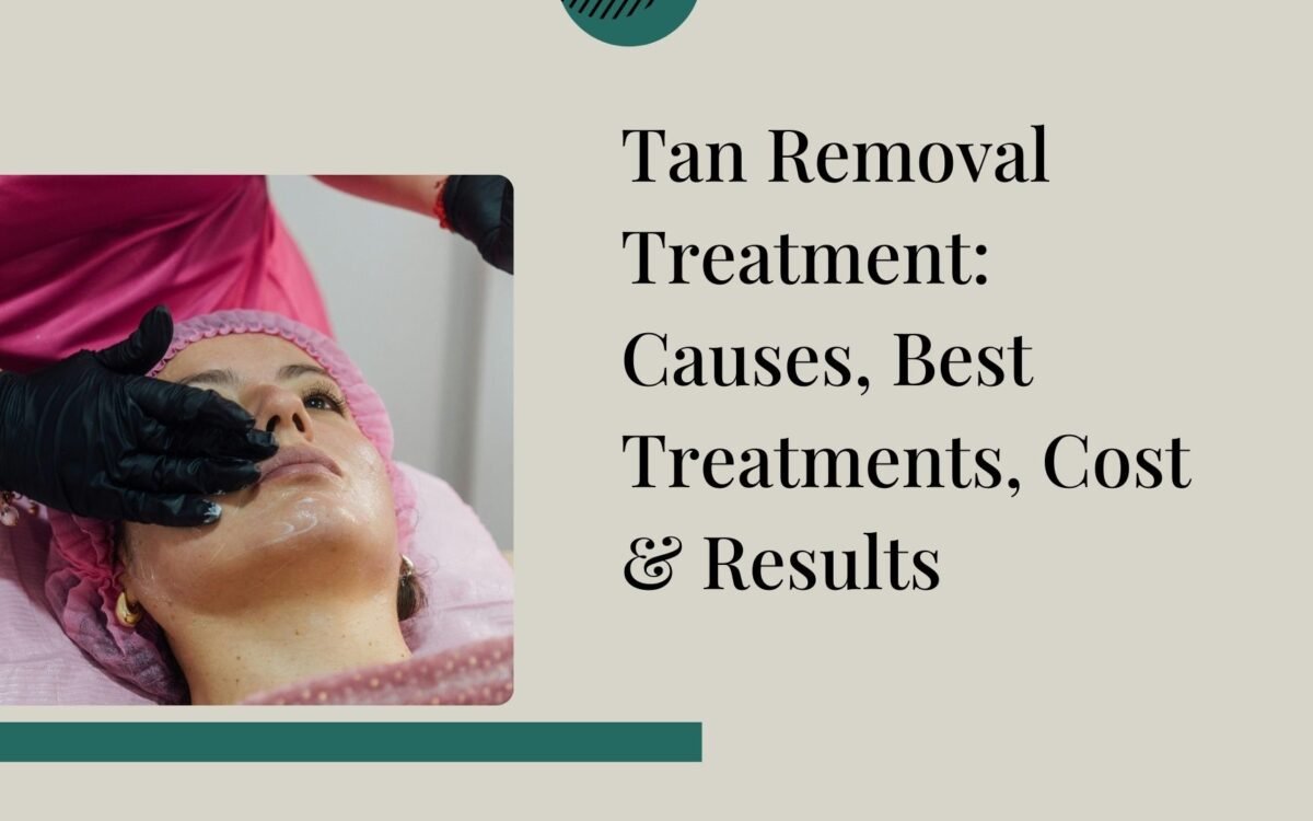 Tan Removal Treatment Causes, Best Treatments, Cost & Results