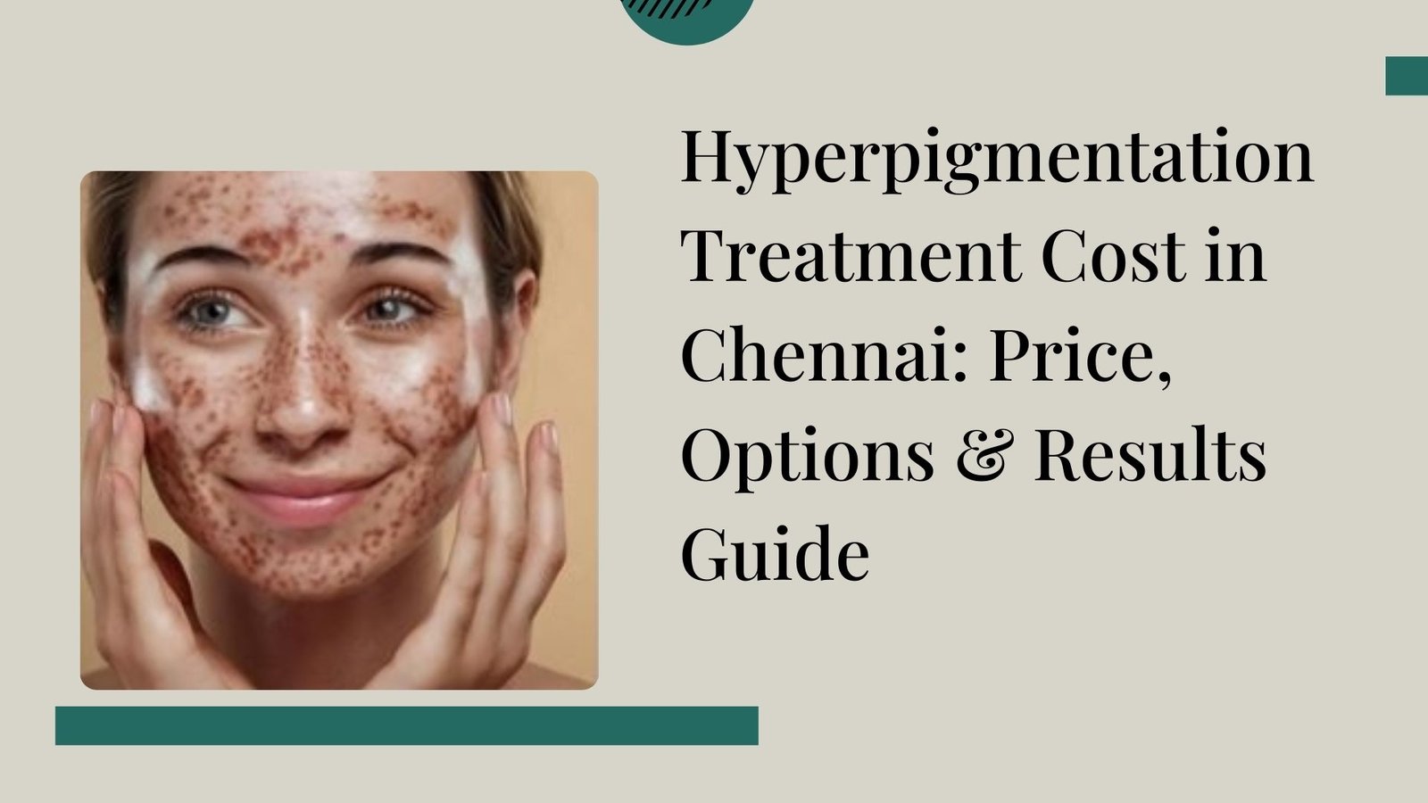 Hyperpigmentation Treatment Cost in Chennai – Price Guide